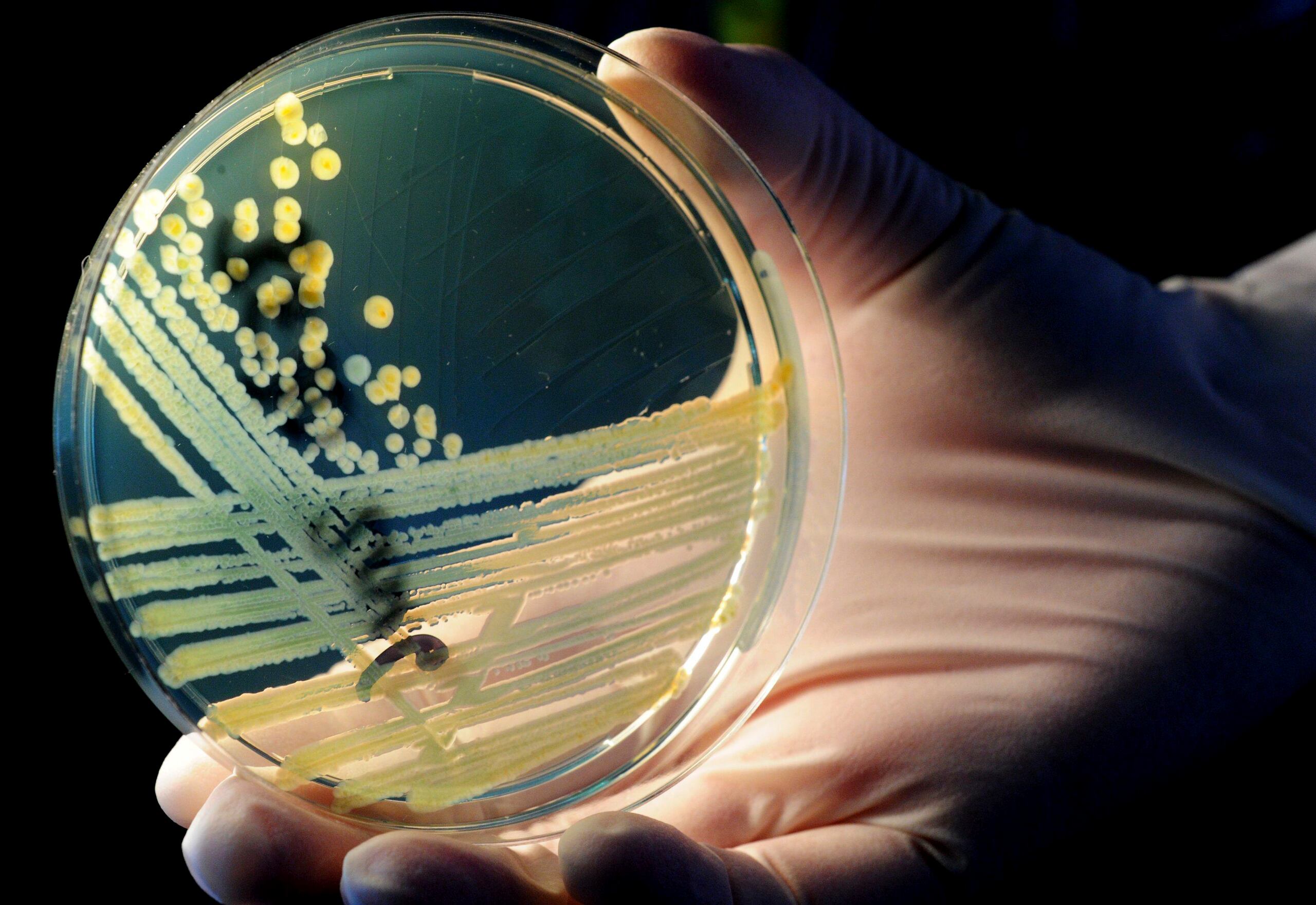 La nueva molécula se inspira en las estructuras químicas de las lincosamidas, una clase de antibióticos que incluye la clindamicina, comúnmente recetada.