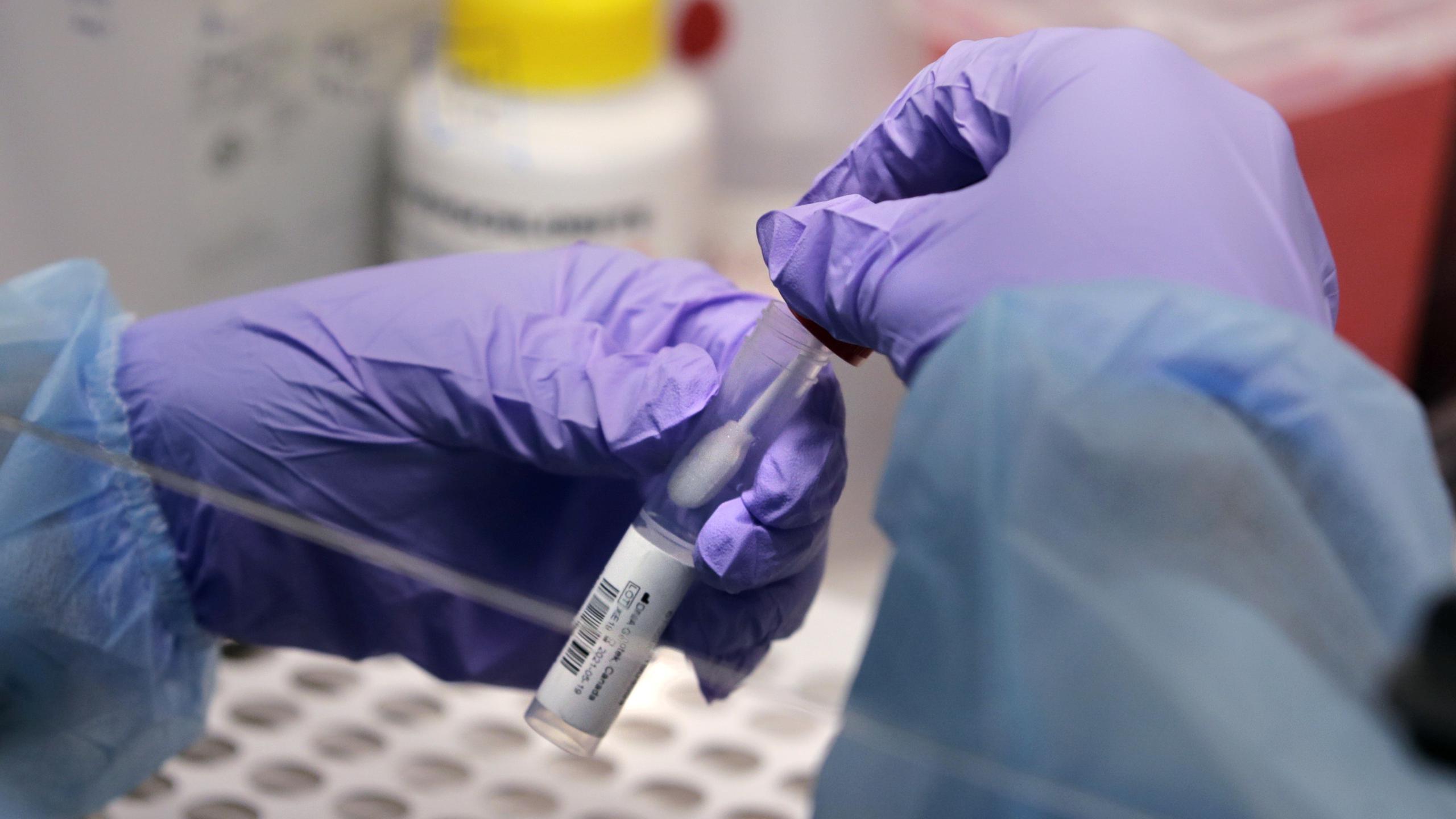 James Robson, estudiante de maestría en ingeniería biomédica, sostiene un hisopo y un vial relacionado con el nuevo coronavirus, en un laboratorio de pruebas en la Universidad de Boston, en Boston