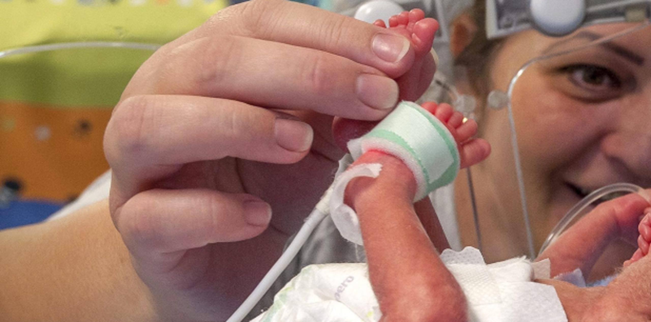 Los niños que nacen prematuros pueden desarrollar complicaciones a largo plazo. (Archivo)