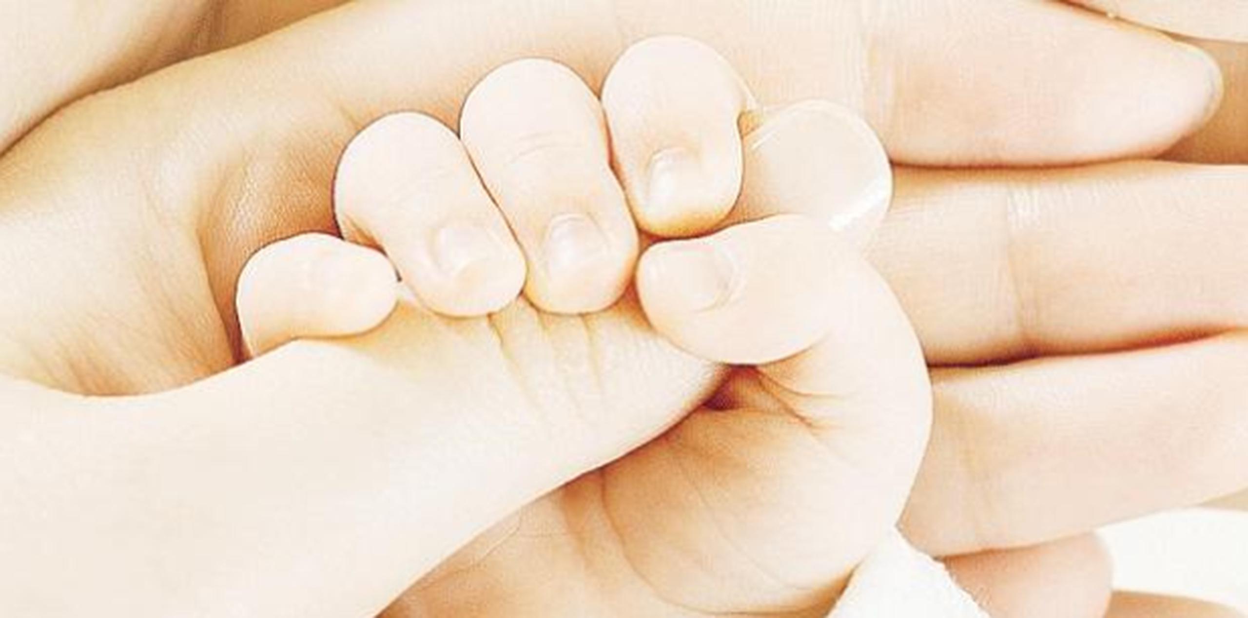 Los investigadores están dando a los bebés nacidos con cesárea una dosis de gérmenes presumiblemente protectores del conducto natal de sus madres. (Archivo)