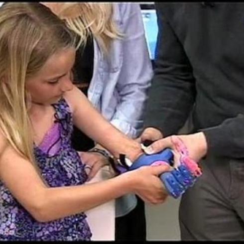 Impresión en 3D permite a niña tener prótesis de mano