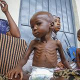 Cientos de personas mueren de hambre en Somalia 
