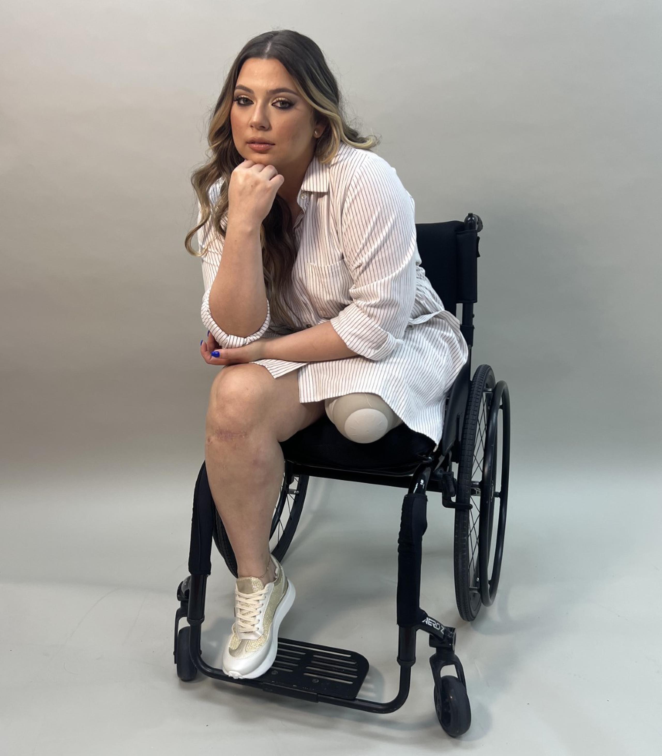 Laura Pérez Hernández perdió una pierna por culpa de un conductor ebrio