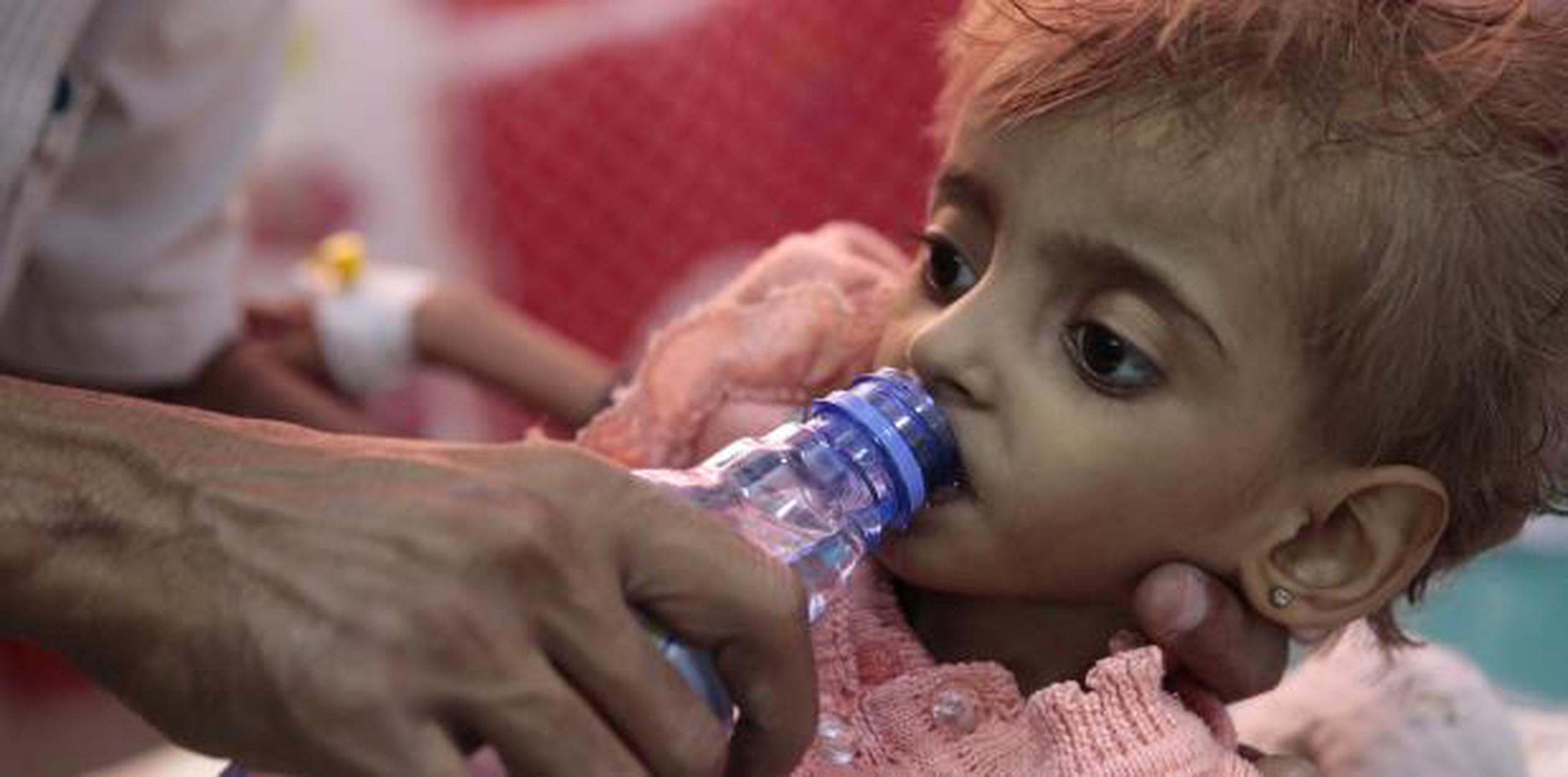 "Por cada niño muerto por bombas y balas, docenas se mueren de hambre y es algo que se puede prevenir completamente", aseguró la directora de la ONG en Yemen, Tamer Kirolos. (AP)