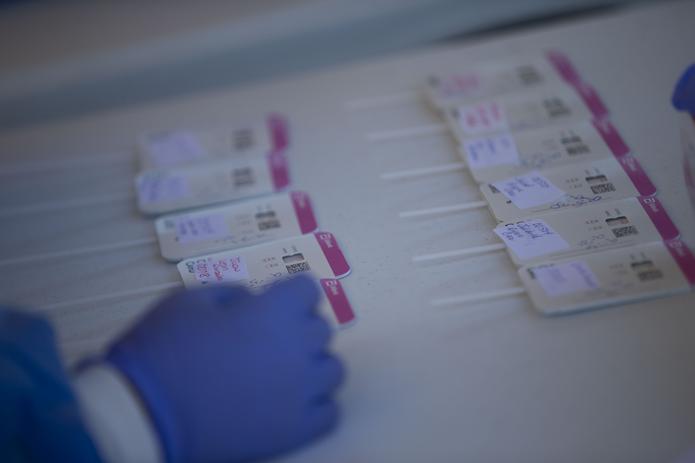 Salud registró un promedio de 2,173 casos positivos detectados mediante pruebas moleculares y un promedio de 5,603 casos positivos probables a través de pruebas de antígenos.